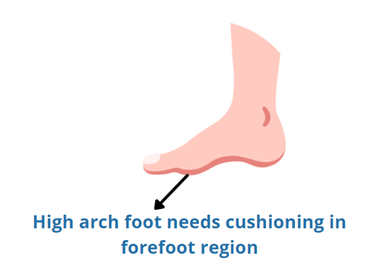 too high arches need cushioning under forefoot